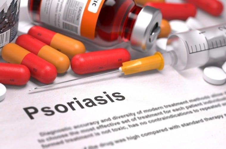 psoriasis-revolution-review-what-you-need-to-know-before-joining-759x500